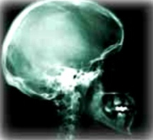 Lateral Skull Projection